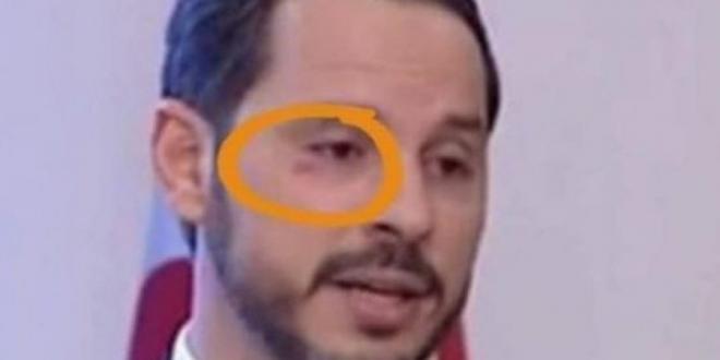 berat-albayrak-eye.jpg