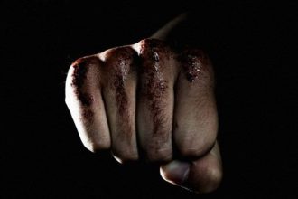 Πάτρα: Σοβαρό επεισόδιο μεταξύ αλλοδαπών στην Αγυιά - Ένας τραυματίας από τη συμπλοκή (ΝΕΟΤΕΡΑ)