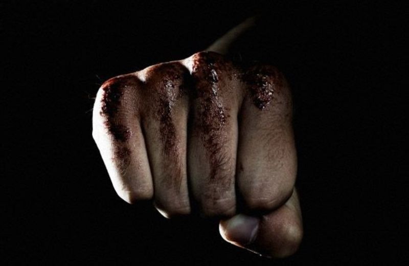 Πάτρα: Σοβαρό επεισόδιο μεταξύ αλλοδαπών στην Αγυιά - Ένας τραυματίας από τη συμπλοκή (ΝΕΟΤΕΡΑ)