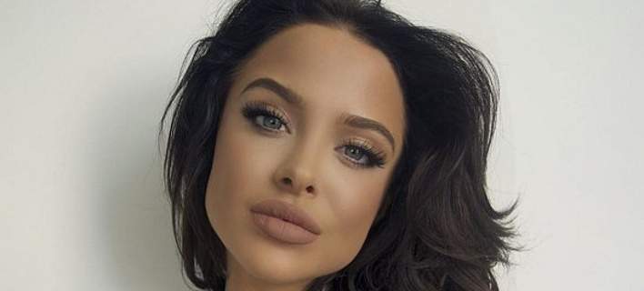 Μάρα Τάιγκεν: Το μοντέλο που είναι ολόιδιο η Αντζελίνα Τζολί -Στο πιο... πλαστικό