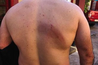 Απίστευτο: Ρομά ξυλοκόπησαν Πυροσβέστες επειδή έσπευσαν να σβήσουν φωτιά