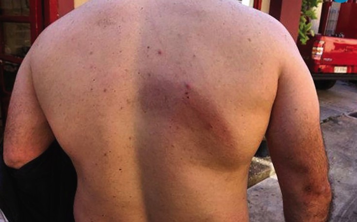 Απίστευτο: Ρομά ξυλοκόπησαν Πυροσβέστες επειδή έσπευσαν να σβήσουν φωτιά