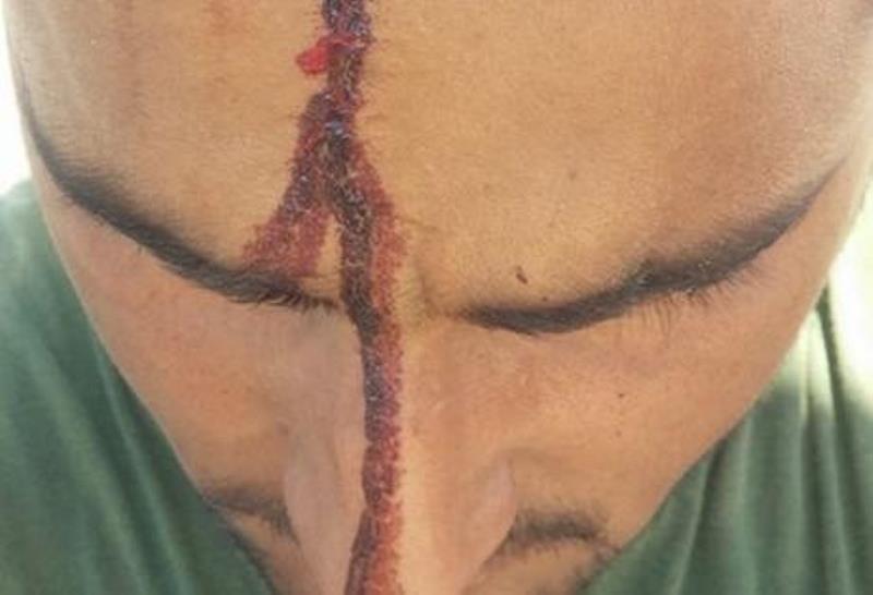 Δυτική Αχαϊα: Χτύπησε στο κεφάλι Πακιστανό επειδή ζήτησε μεροκάματα πέντε μηνών