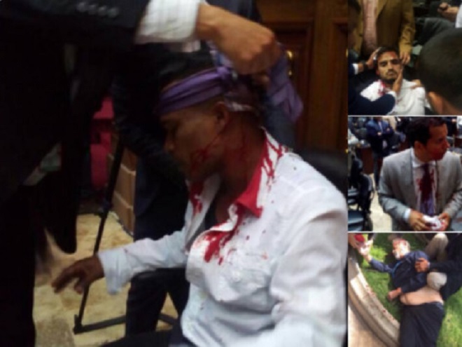 Χάος στη Βενεζουέλα - Υποστηρικτές του Μαδούρο "μπούκαραν" με ρόπαλα στο Κοινοβούλιο - ΔΕΙΤΕ ΦΩΤΟ και ΒΙΝΤΕΟ