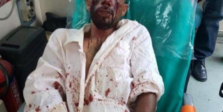 Γνωστοί στις Αρχές οι δράστες της δολοφονικής επίθεσης κατά μεταναστών - ΦΩΤΟ