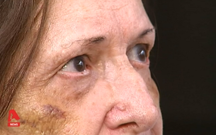 «Με πέταξαν στο κρεβάτι και το σίδερο ήταν αναμμένο δίπλα μου» - ΔΕΙΤΕ ΒΙΝΤΕΟ