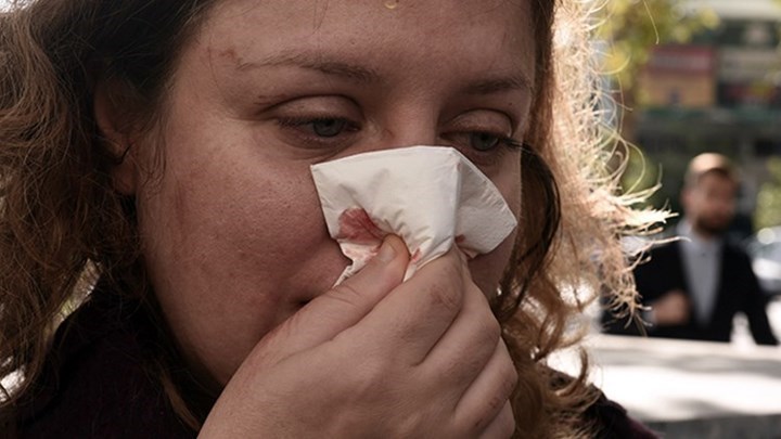 Αναγνωρίστηκε στέλεχος της Χρυσής Αυγής για τον τραυματισμό της δικηγόρου έξω από το Εφετείο