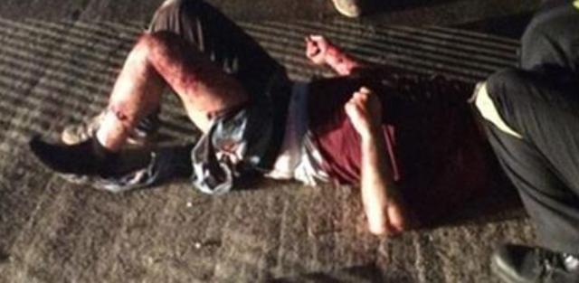 Αχαΐα: "Μάστιγα" οι επιθέσεις αδέσποτων σκύλων - Δυο περιστατικά μέσα σ΄ένα 24ωρο