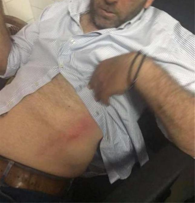 Δυο συλλήψεις για τα χθεσινά επεισόδια στον αγώνα Αστέρας Αμαλιάδας - Ηρόδοτος