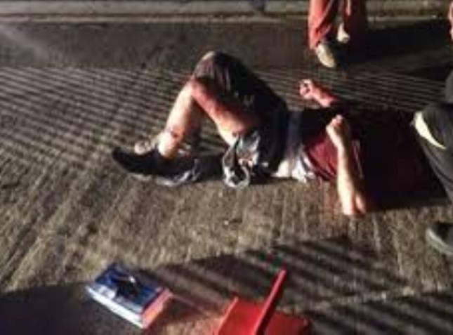 Πάτρα: Περπατούσε και δέχθηκε επίθεση σκύλου - Στο Νοσοκομείο 30χρονος με δαγκώματα σε όλο του σώμα