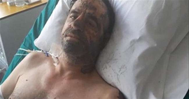 Μάτι: Ανατριχιαστική μαρτυρία εγκαυματία - Δεν τα κατάφερε η σύζυγος του