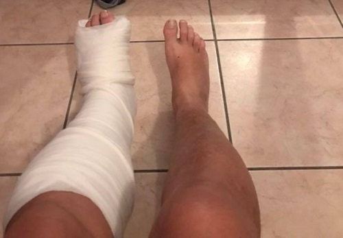 Αίγιο: ΙΧ παρέσυρε οδηγό μηχανής και τον εγκατέλειψε - Το θύμα αφηγείται το περιστατικό