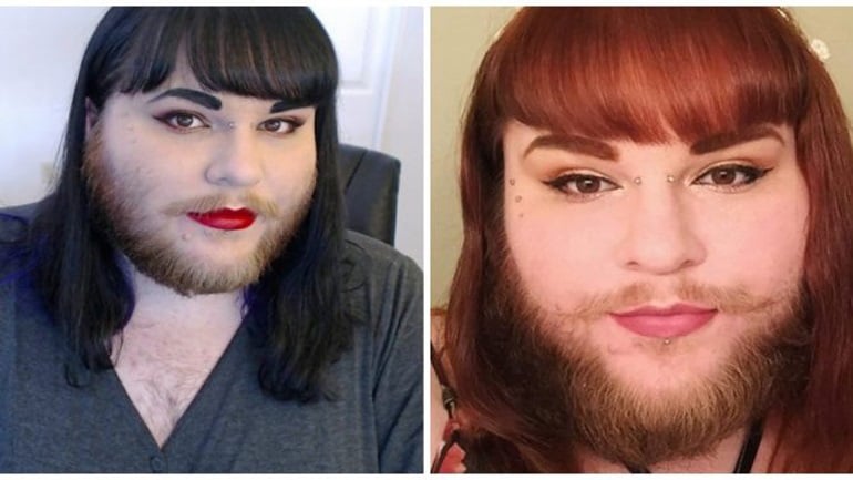 Iνδός χώρισε τη γυναίκα του επειδή όταν της έβγαλε την μαντίλα ανακάλυψε ότι έχει μούσι