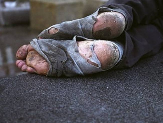 Πάτρα: Το δράμα ενός αστέγου... ήταν πίσω από το συναγερμό για φωτιά!