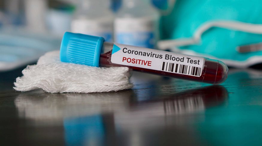 Αίγινα: Θετικός στον κορονοϊό ταξιδιώτης από το εξωτερικό