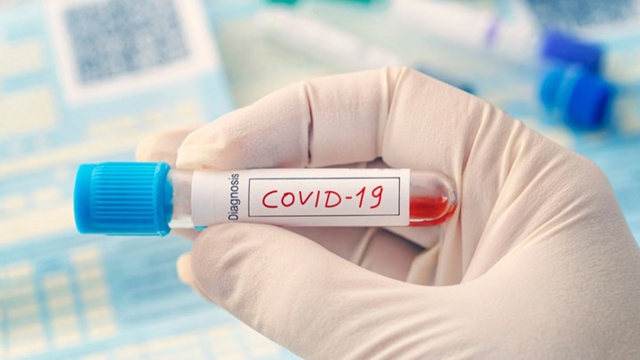 Λάρισα: Ήταν καλεσμένος σε γάμο το ένα από τα τρία νέα κρούσματα