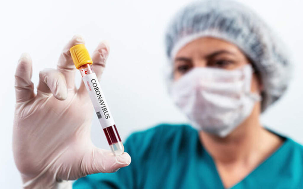 Θεσσαλονίκη - Θετικοί στον κορονοϊό 14 εργαζόμενοι σε εταιρεία