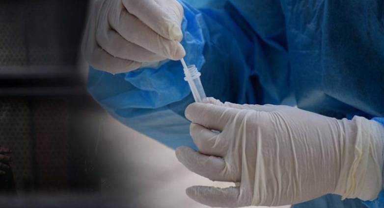 Αχαΐα: Πως κατανέμονται ανά περιοχή τα 65 κρούσματα που ανακοίνωσε το Σάββατο ο ΕΟΔΥ