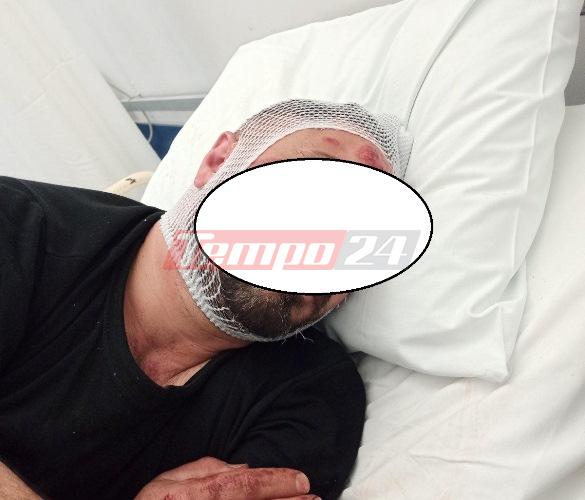 Αχαΐα: "Πάτησε" με το αυτοκίνητό του γνωστό επιχειρηματία! Μιλάει στο tempo24 ο αδερφός του τραυματία - Σοκάρει το ΒΙΝΤΕΟ - Δείτε ΦΩΤΟ