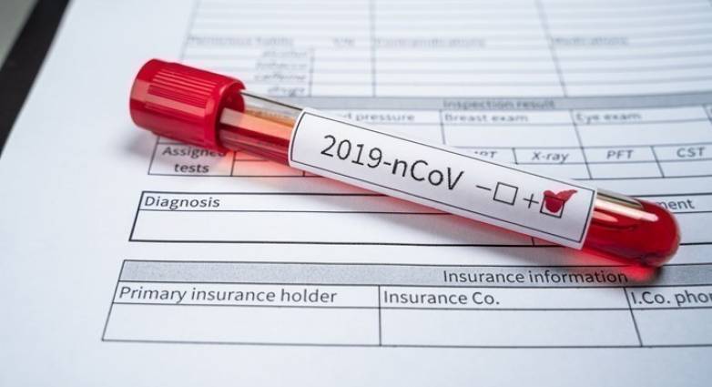 Κορονοϊός: Καθαρά Δευτέρα με μικρή άνοδο κρουσμάτων για την Αχαΐα - Πόσα εντοπίστηκαν στη Δυτική Ελλάδα