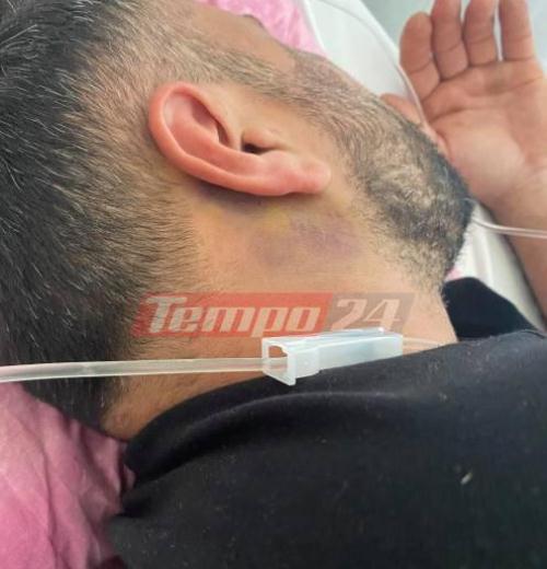 Πάτρα: Σε δύσκολη χειρουργική επέμβαση υπεβλήθη ο Νικήτας Σκάγιας - Είχε παρασυρθεί από όχημα στην περιοχή της ΒΙΠΕ - "Ακόμα ταλαιπωρείται", λέει στο tempo24 o αδερφός του - ΦΩΤΟ