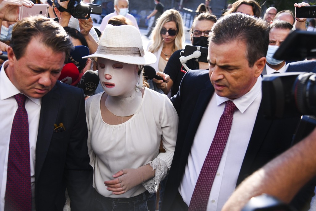 Επίθεση με βιτριόλι – Η μεγάλη μάχη της Ιώννας για να μην χάσει το μάτι της – Τι λέει ο γιατρός της