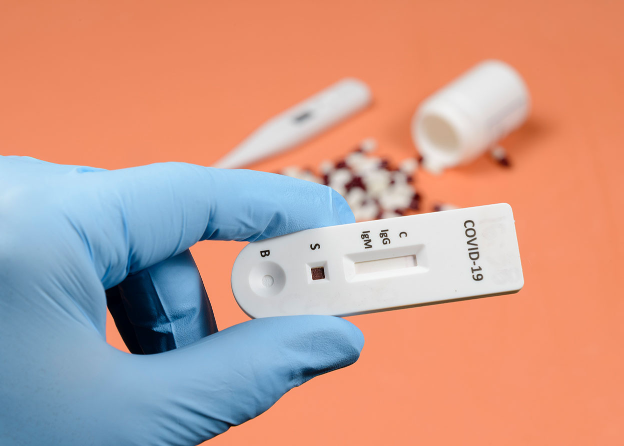 Πάτρα: Πού θα γίνουν την Πέμπτη δειγματοληπτικοί έλεγχοι για τον κορονοϊό