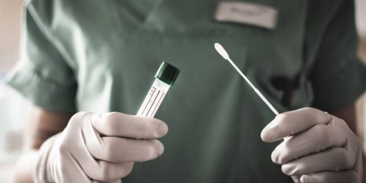 ΕΟΔΥ: Σε 29 σημεία τα δωρεάν τεστ για τον κορωνοϊό σήμερα Κυριακή