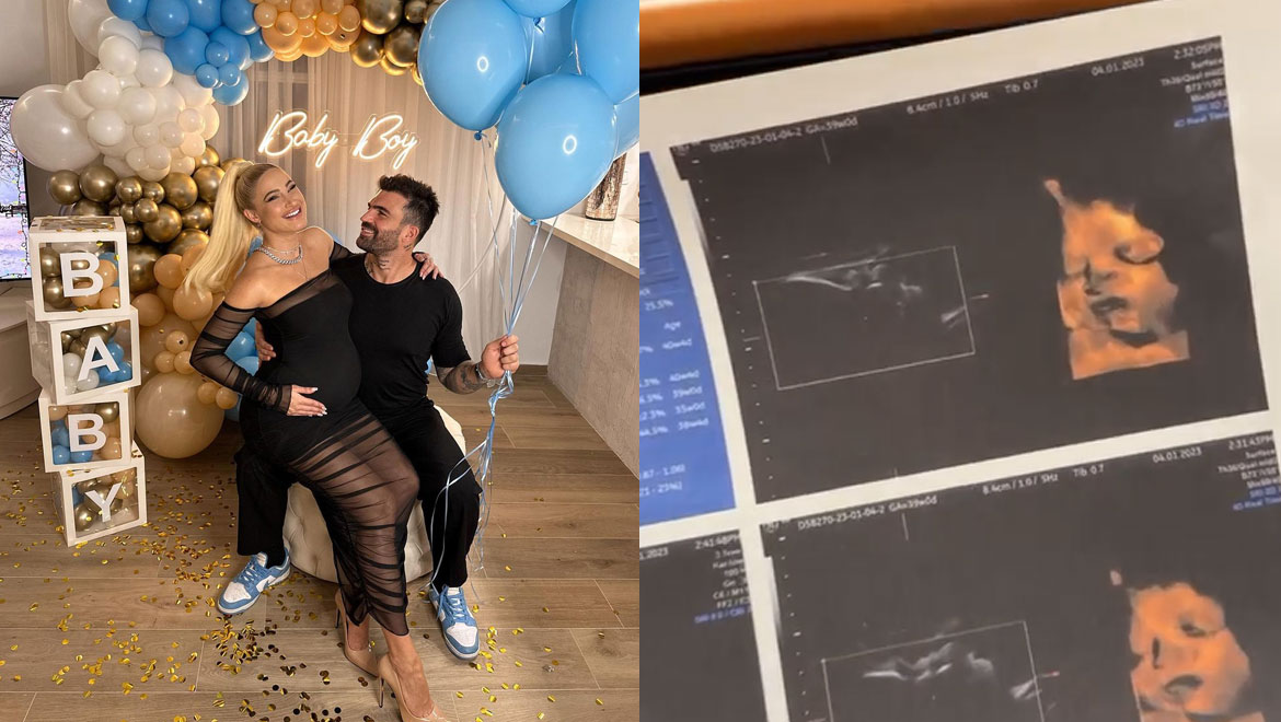 Δημήτρης Αλεξάνδρου: «Έπαθα σοκ όταν είδα το υπερηχογράφημα του μωρού μου»