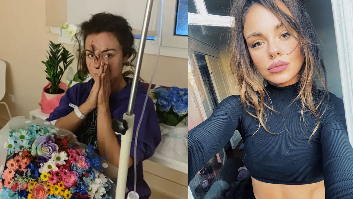 Πρώην παίκτρια του Big Brother ήταν στο βαγόνι 3: «Έπρεπε να αποφασίσω αν θα καώ ή θα σπάσω τα κόκαλά μου»