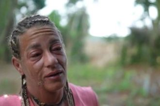 Survivor All Star - Αφροδίτη Σκαφίδα: Εσπευσμένα στο νοσοκομείο - Πρήστηκε το πρόσωπό της