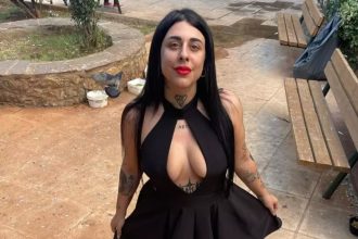 Σούπερ Κική: Ποζάρει χωρίς ρούχα μετά τη λιποαναρρόφηση - «Τα ράμματα δεν τα έχω βγάλει»