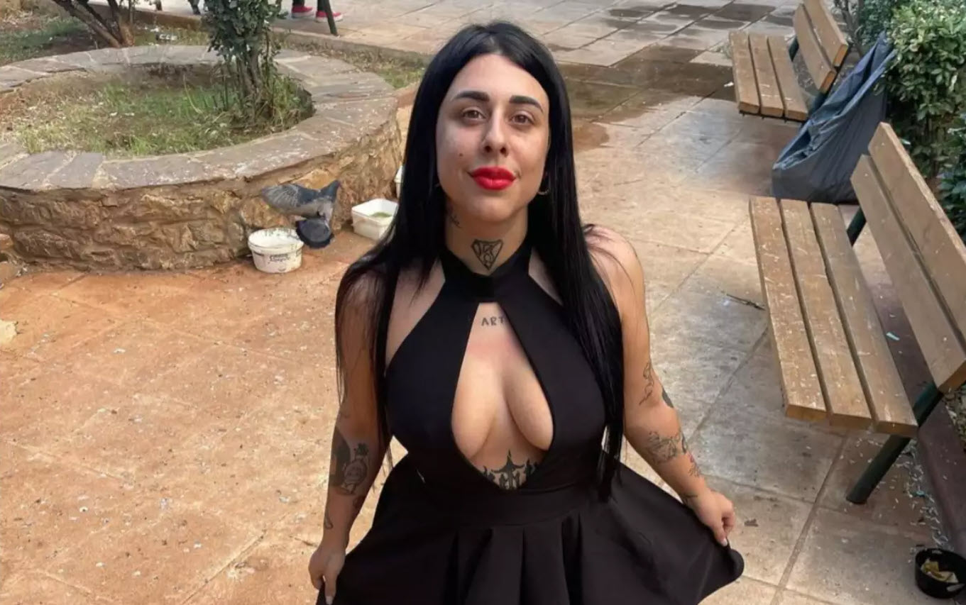 Σούπερ Κική: Ποζάρει χωρίς ρούχα μετά τη λιποαναρρόφηση - «Τα ράμματα δεν τα έχω βγάλει»