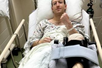 Εκτάκτως στο χειρουργείο ο Μαρκ Ζούκερμπεργκ
