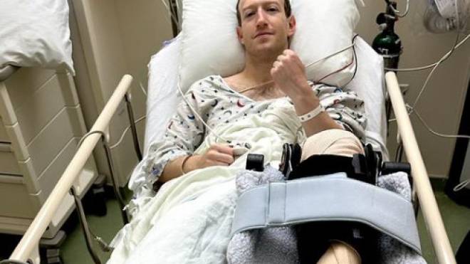 Εκτάκτως στο χειρουργείο ο Μαρκ Ζούκερμπεργκ