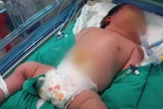 Το βαρύτερο μωρό στον κόσμο γεννήθηκε στη Χιλή