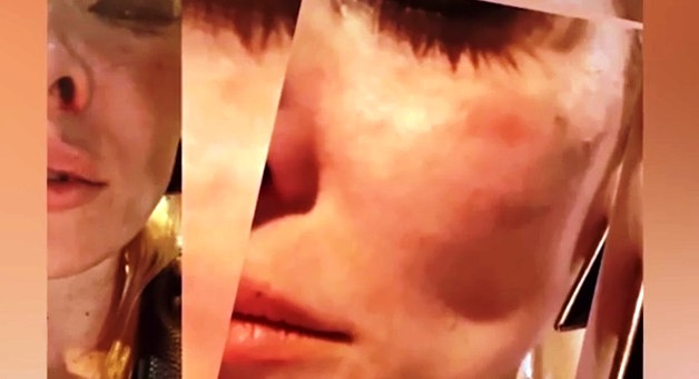 Μικαέλα Φωτιάδη: Θύμα άγριου ξυλοδαρμού το γνωστό μοντέλο - ΕΙΚΟΝΕΣ ΣΟΚ