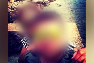 Εικόνες σοκ από την 32χρονη που κακοποιήθηκε βάναυσα από τον σύζυγό της στο Άργος - «Μου είπε θα φτύσεις αίμα»