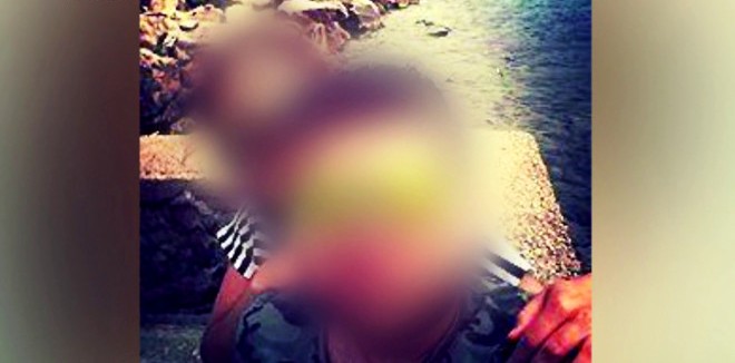 Εικόνες σοκ από την 32χρονη που κακοποιήθηκε βάναυσα από τον σύζυγό της στο Άργος - «Μου είπε θα φτύσεις αίμα»