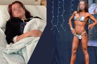 Άγριος ξυλοδαρμός γυναίκας πρώην bodybuilder από τον σύζυγό της - «Προσπάθησε να με πνίξει»