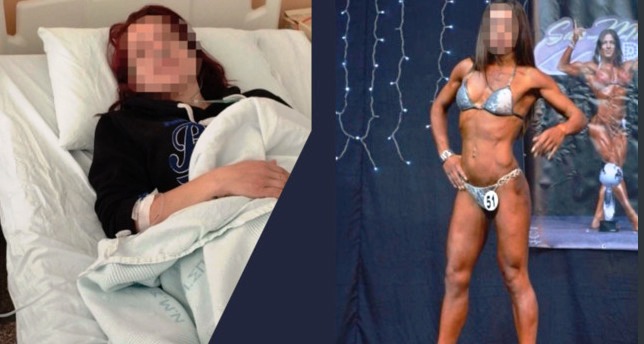 Άγριος ξυλοδαρμός γυναίκας πρώην bodybuilder από τον σύζυγό της - «Προσπάθησε να με πνίξει»