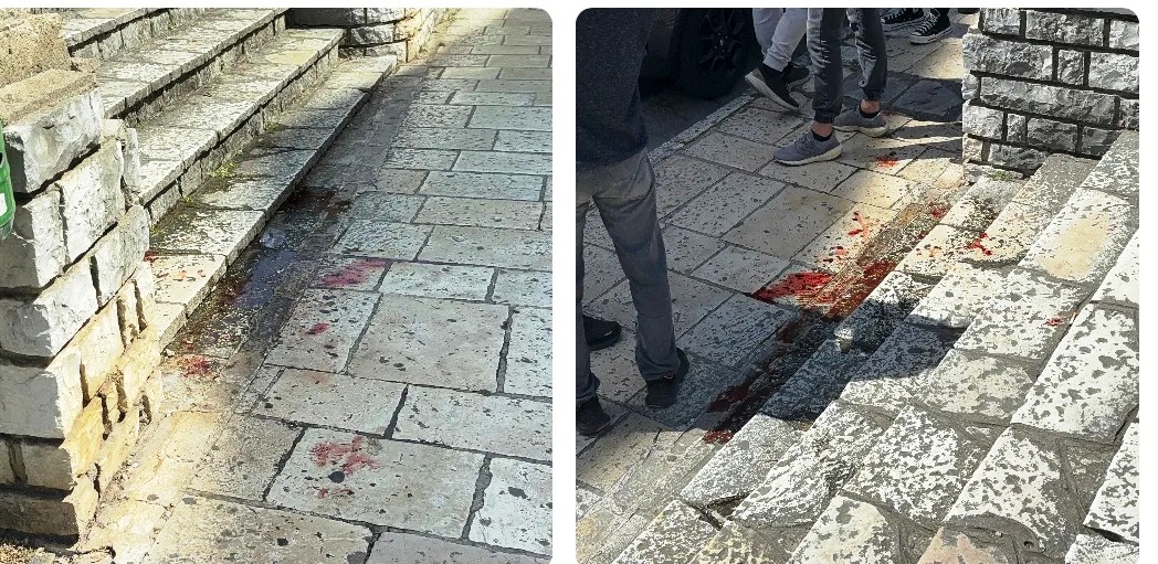 Μαθητής σε αμόκ μαχαίρωσε τρία άτομα σε κεντρική πλατεία! (ΦΩΤΟ)