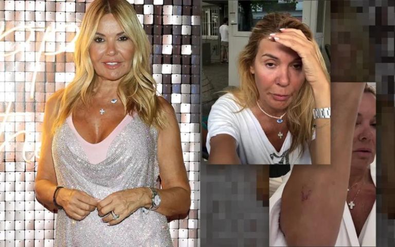 Χριστίνα Παππά για την επίθεση που δέχτηκε: «Πονάει όλο μου το σώμα, βρέθηκε κάτι στον αυχένα»