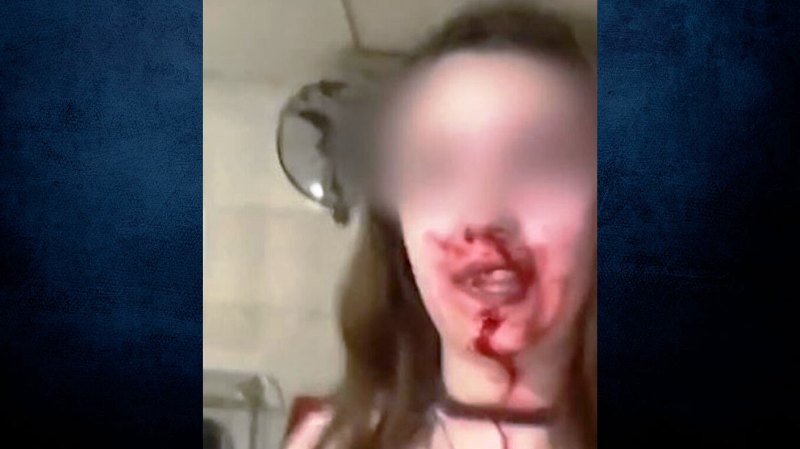 Γυναίκα με αίματα στο πρόσωπο καταγγέλλει ότι την ξυλοκόπησε ο σύζυγός της - ΒΙΝΤΕΟ ΣΟΚ