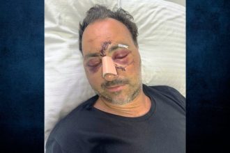 Άγριος ξυλοδαρμός Ελληνοκαναδού χρηματιστή στην Κρήτη για μια παρατήρηση - Του έκαναν 60 ράμματα στο κεφάλι