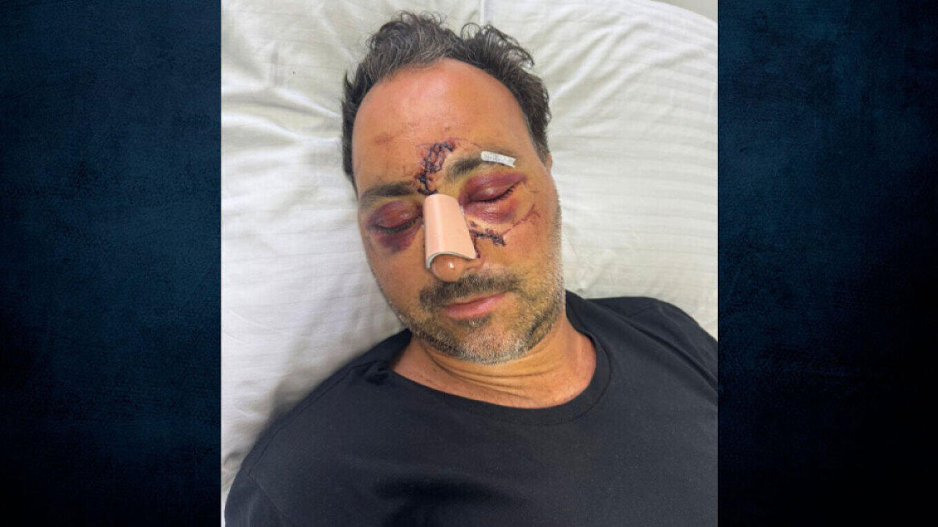 Άκαρπες οι έρευνες για τον εντοπισμό των δραστών που ξυλοκόπησαν τον Ελληνοκαναδό χρηματιστή στο Ηράκλειο