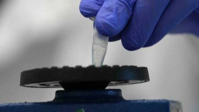 Η Αυστραλία σε υγειονομικό συναγερμό για έξαρση της νόσου των λεγεωναρίων – Νεκρή μία 90χρονη, δεκάδες κρούσματα μέσα σε ένα 24ωρο