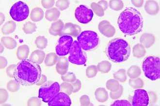 Παρουσιάστρια ανακοινώνει στον αέρα ότι έχει λευχαιμία: «Είναι ένα σοκ, δύσκολο να το πω»