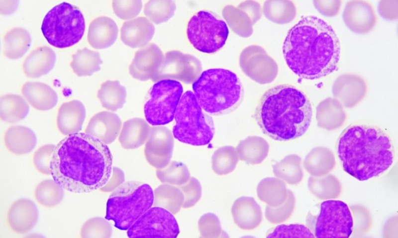 Παρουσιάστρια ανακοινώνει στον αέρα ότι έχει λευχαιμία: «Είναι ένα σοκ, δύσκολο να το πω»