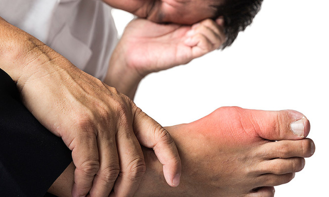 Ουρικό οξύ: Αν νιώθετε αυτά, κάντε εξετάσεις!